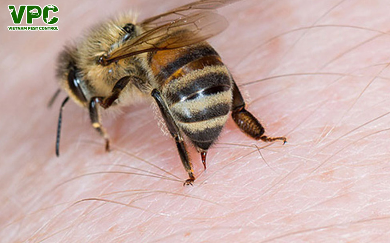 ong độc chích đau không ?